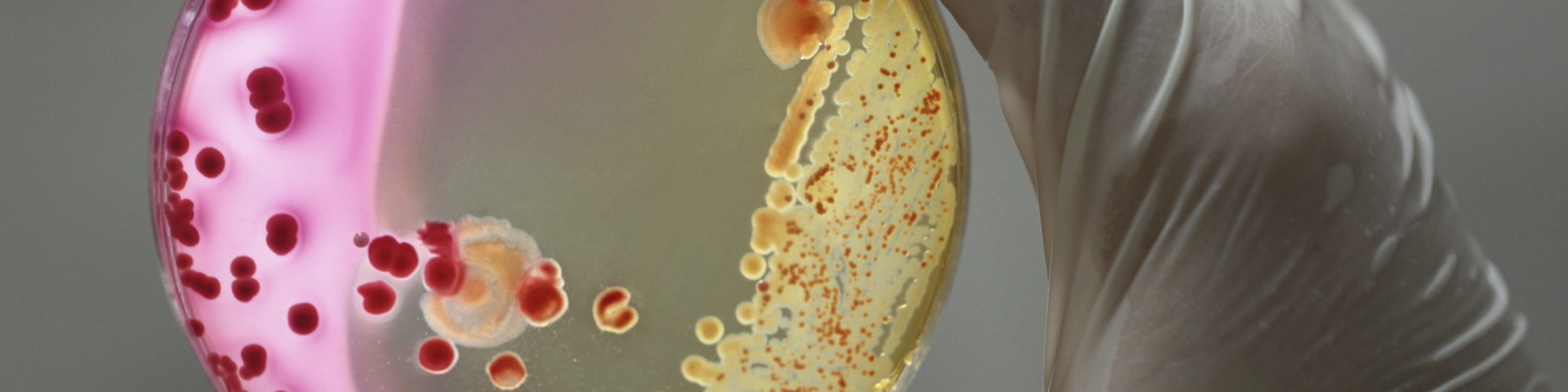 bacteria Bacteria macro photographed media in petri dishes in the laboratory